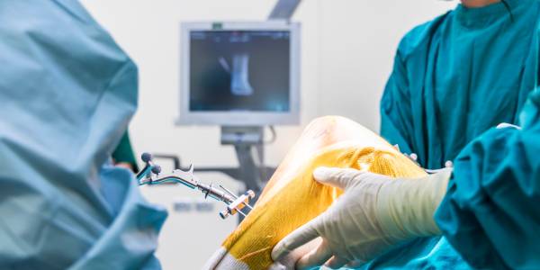 Surgeon's in blue gown using robotic navigator for knee joint arthroplasty surgery inside an operating room while the monitor displays the progress of the surgery on screen.